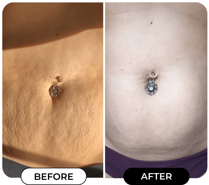 Results of using product B-FLAT from @Bri_rumsey44