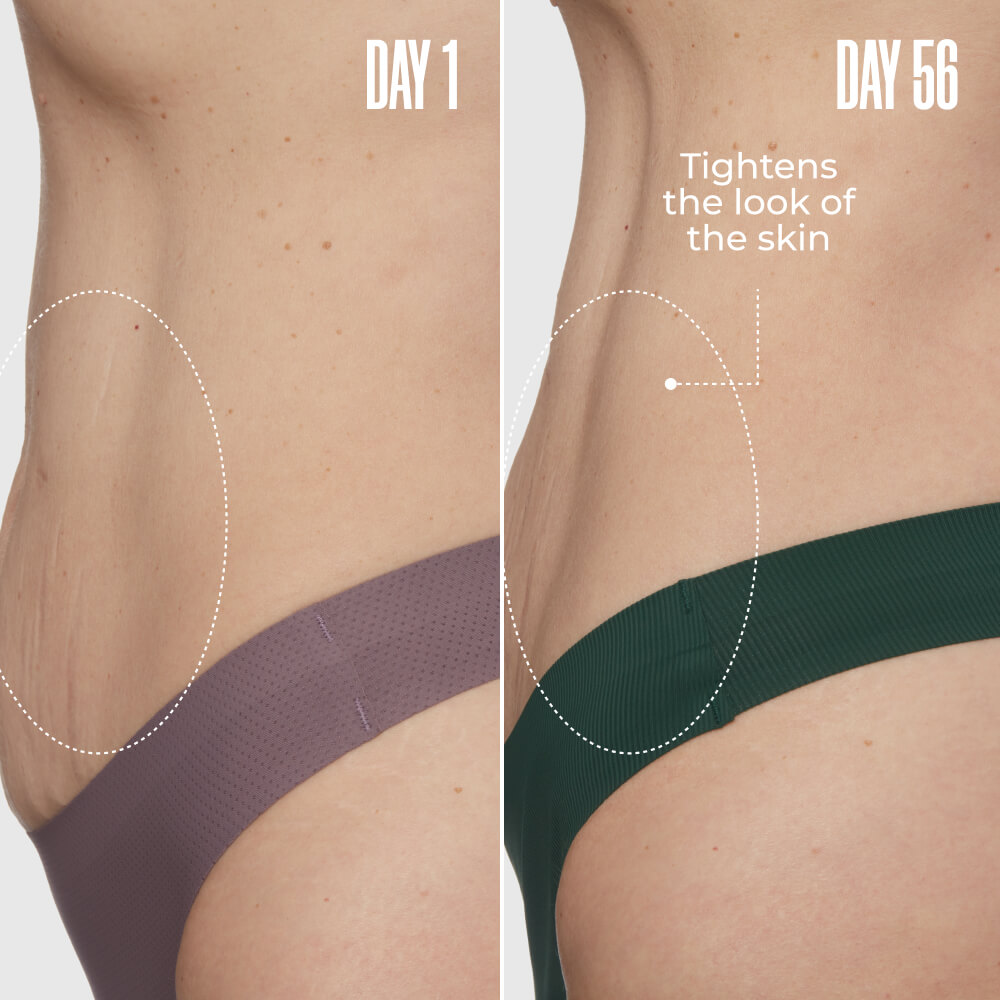 GET FLATTERED The Loose Skin Duo | MAЁLYS®