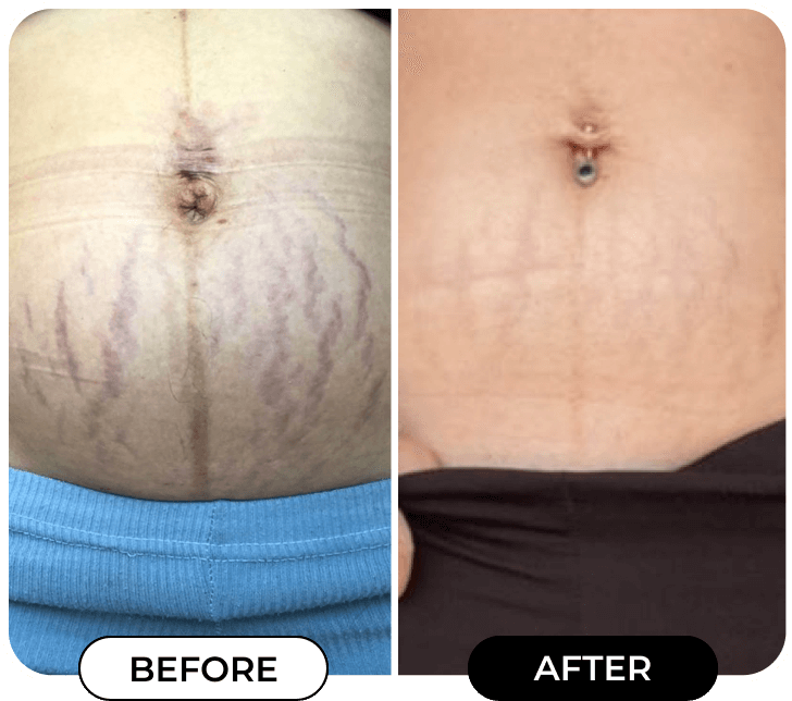 Results of using product B-FLAT from @Kaylaschut