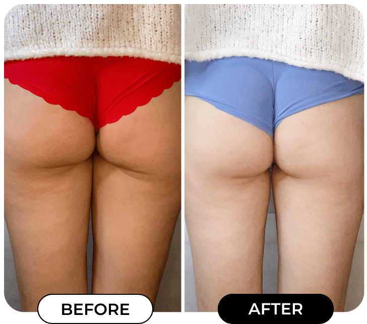 Results of using product B-TIGHT from @Mlle_jasminmacrae