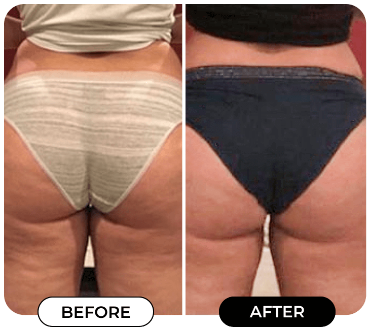 Results of using product B-TIGHT from @Knlucero3