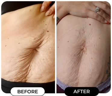 Results of using product B-FLAT from @Kashafierceeee