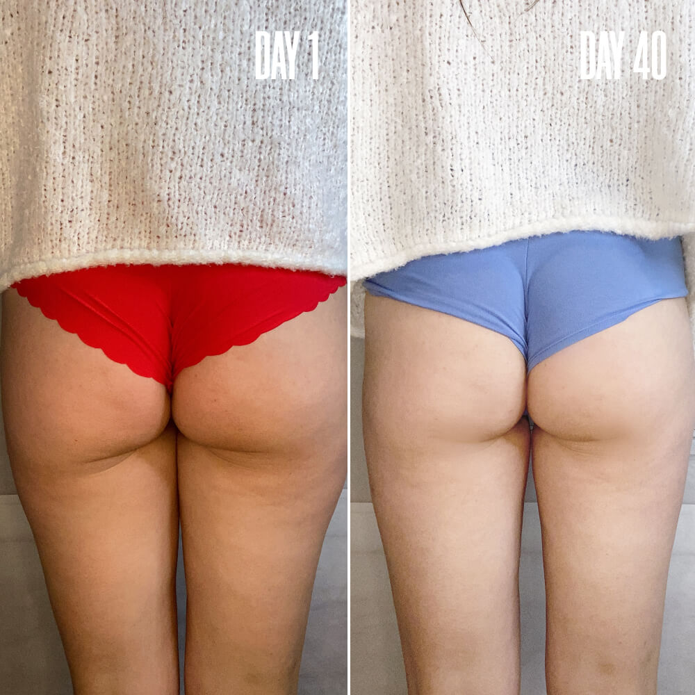 SHAPERS The Loose Skin Bundle | MAЁLYS®