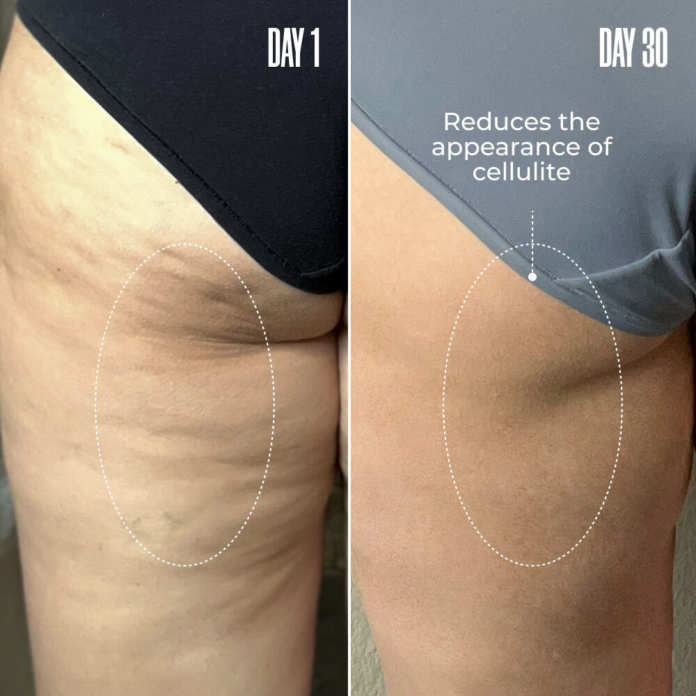 HEROES Total Body Sculpt Bundle | MAЁLYS®