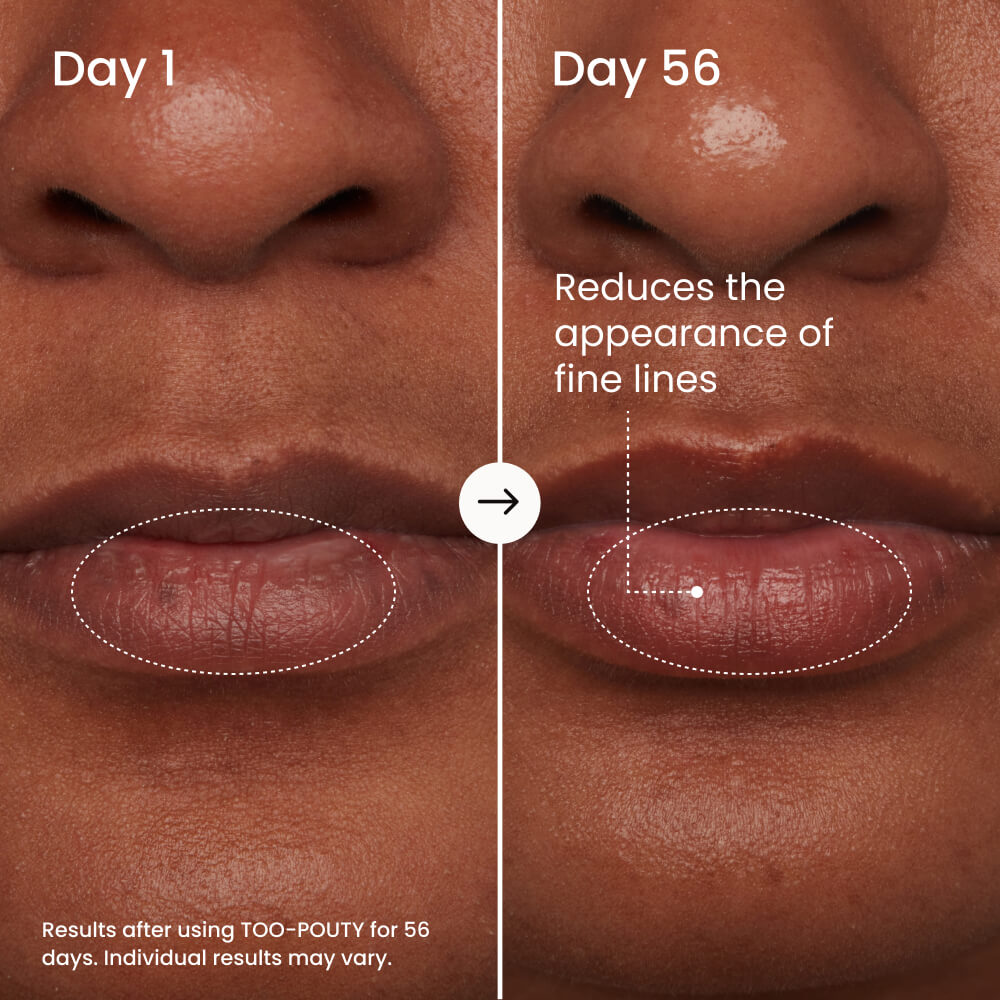 TOO-POUTY Clinically Proven Lip Plumping Mask