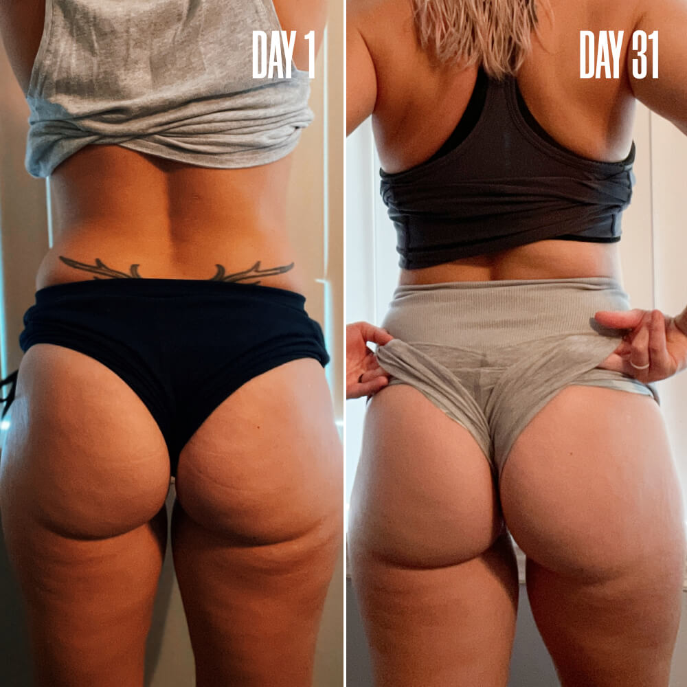 SHAPERS The Loose Skin Bundle | MAЁLYS®