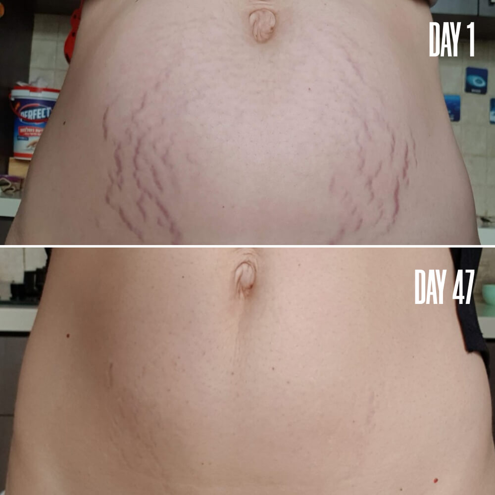 BODY RESHAPING COLLECTION The Firming Bundle – Save $20