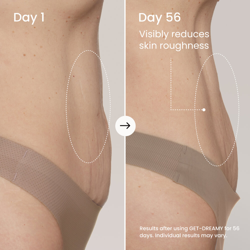GET-DREAMY Overnight Toning Whip