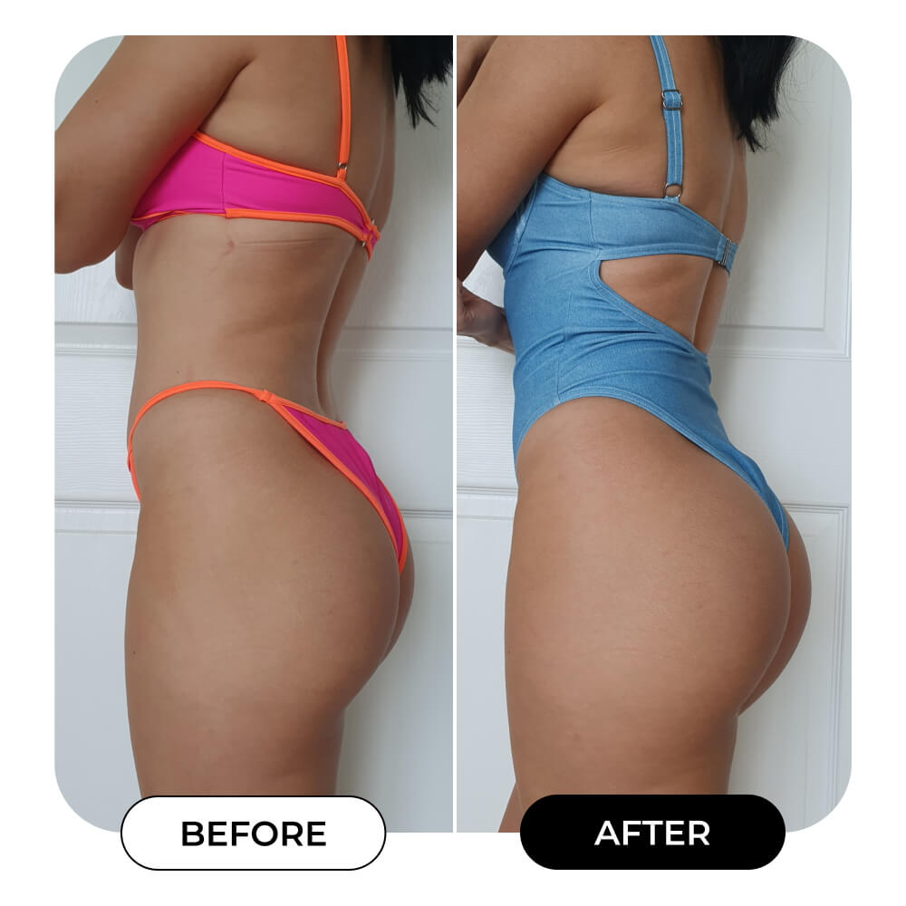 HEROES Total Body Sculpt Bundle | MAЁLYS®