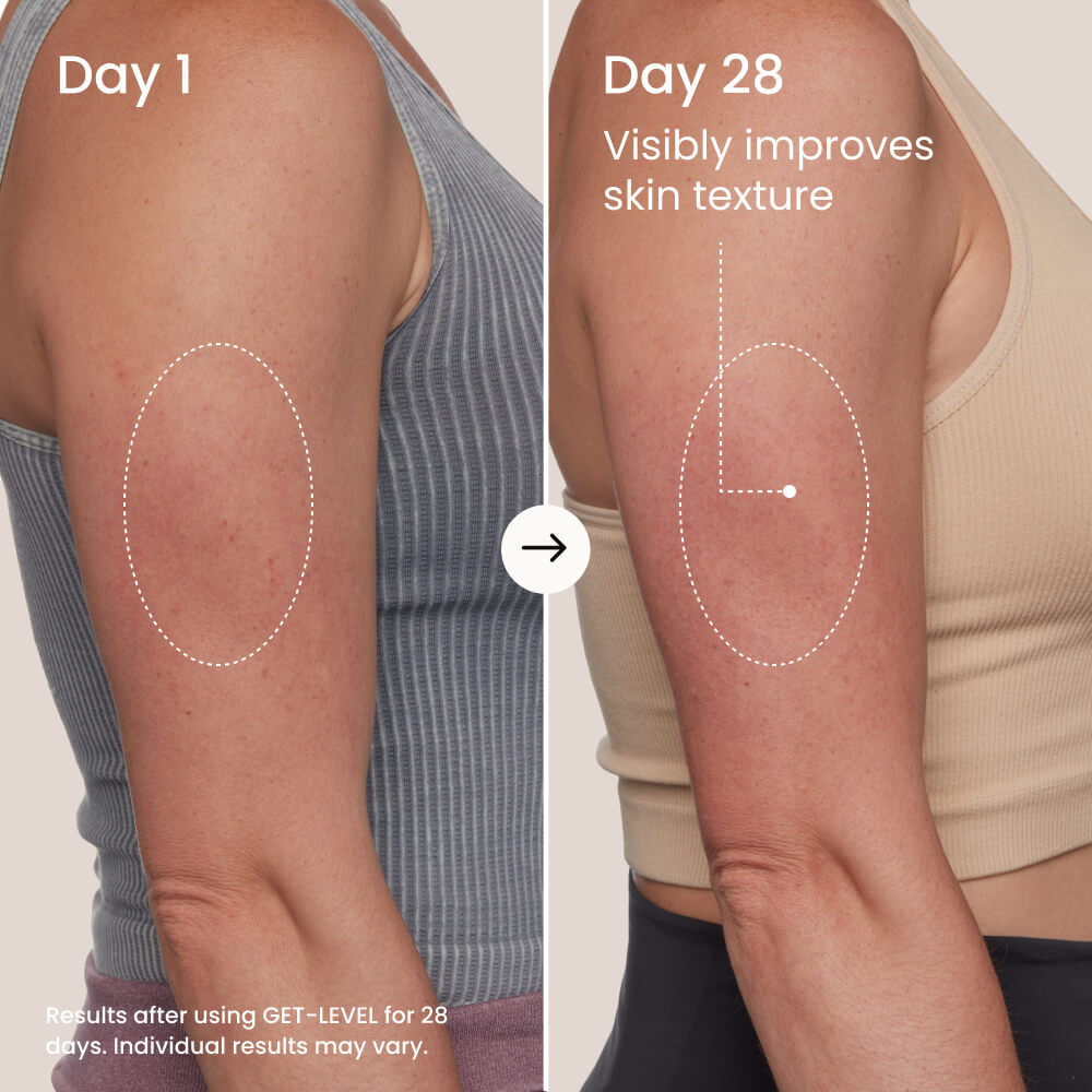 GET-LEVEL Keratosis Pilaris Body Scrub