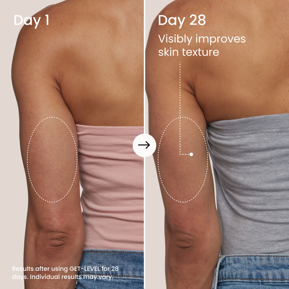 GET-LEVEL Keratosis Pilaris Body Scrub