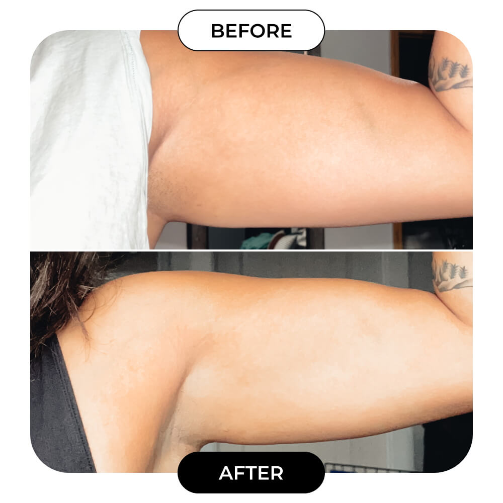 B-FLEX Lift & Firm Arm Cream