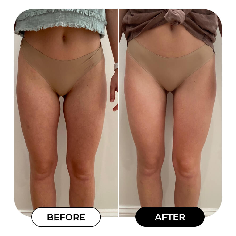 B-FOXY Inner Thigh Firming Cream