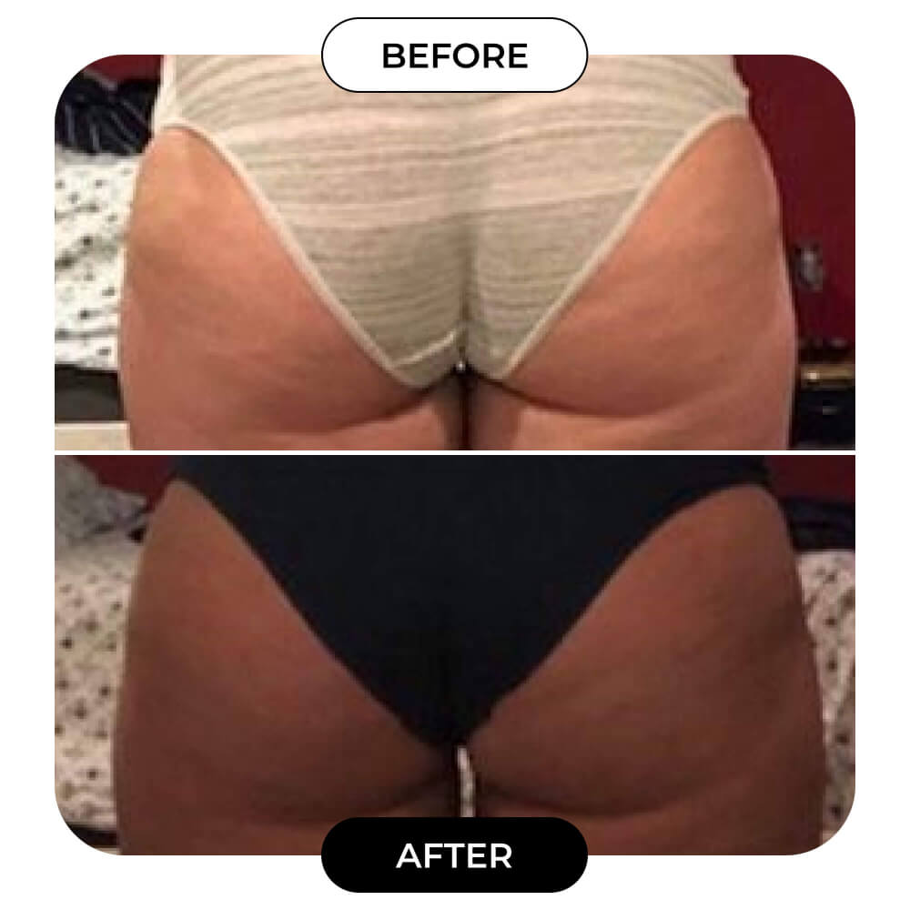 B-TIGHT Booty Lifting & Tightening Cream | MAЁLYS®