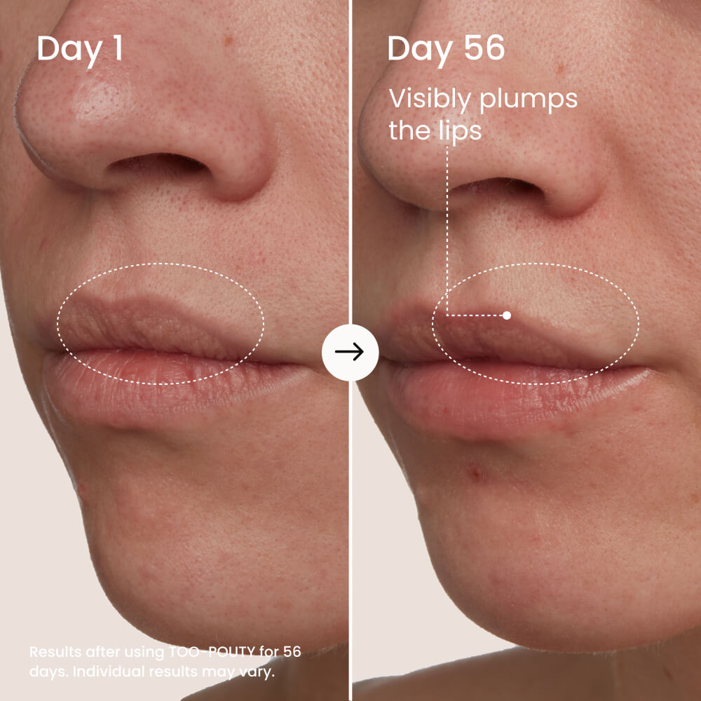 TOO-POUTY Clinically Proven Lip Plumping Mask