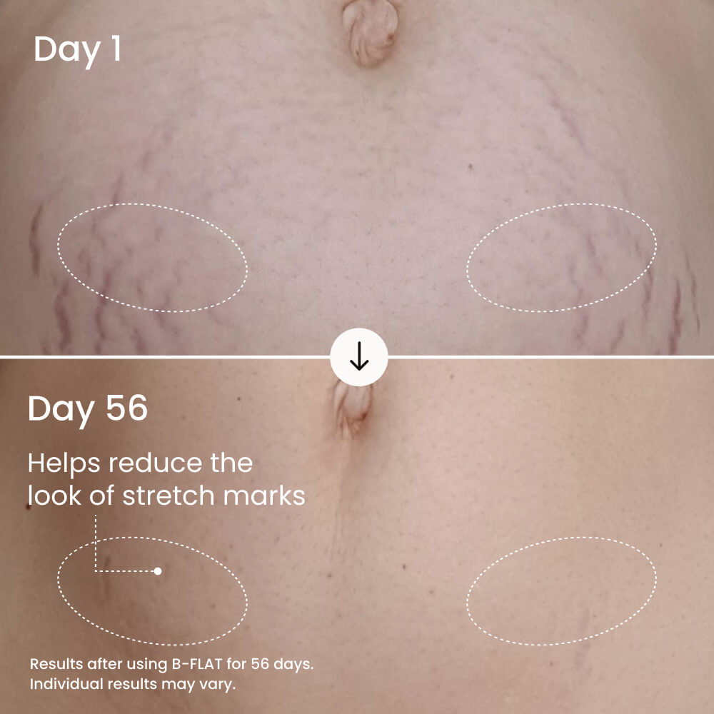 B-FLAT Belly Firming Cream