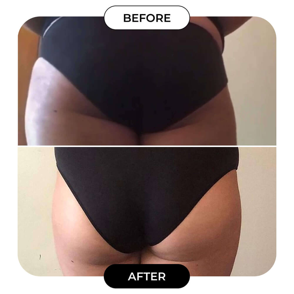 B-TIGHT Booty Lifting & Tightening Cream | MAЁLYS®