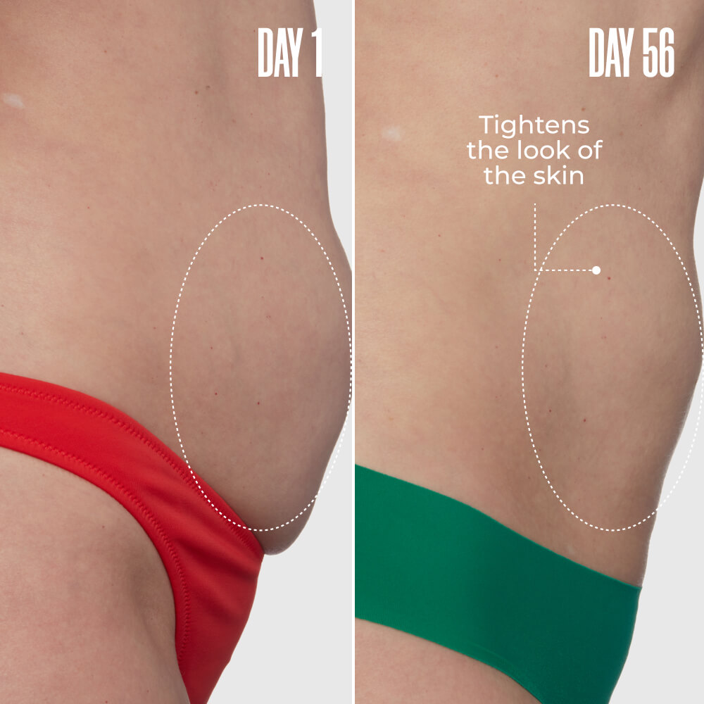 GET FLATTERED The Loose Skin Duo | MAЁLYS®