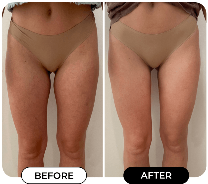 Results of using product B-FOXY from @mrs.mlwilliams