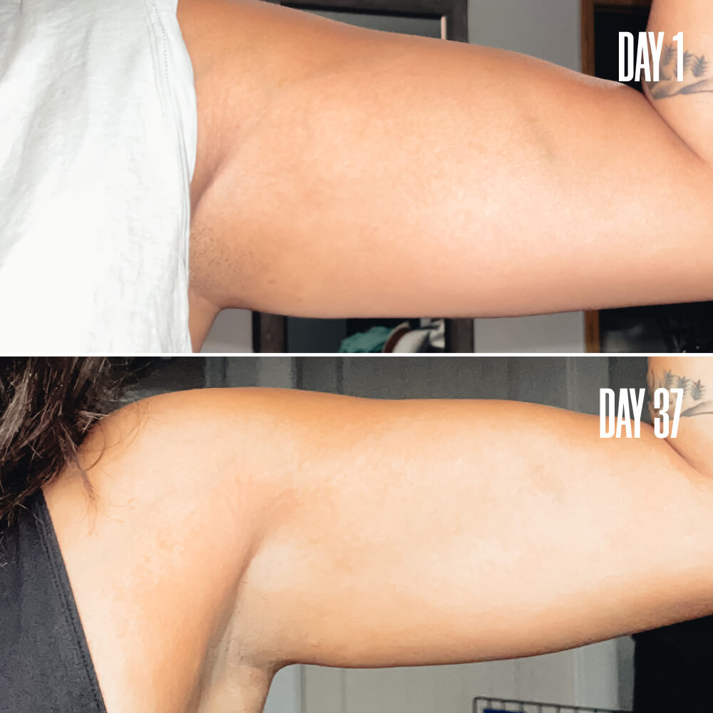 SHAPERS The Loose Skin Bundle | MAЁLYS®