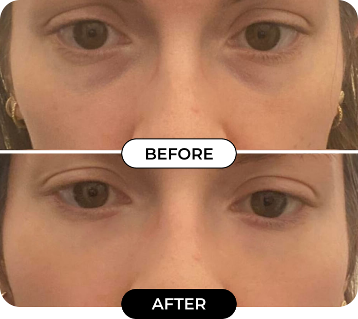 Results of using product WOW-IT from Michelle D.