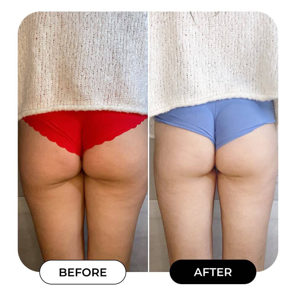 HEROES Total Body Sculpt Bundle | MAЁLYS®